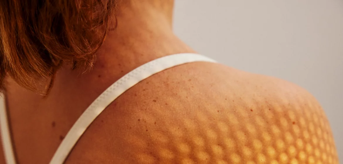 SPF 50 schützt nicht den ganzen Tag: Wie viel Sonnencreme nötig ist, wann nachgecremt werden muss und wie sich Sonnenbrand vermeiden lässt.